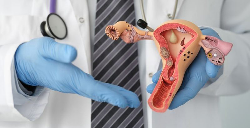 İdrar Torbası Sarkmalarının (Sistosel) Tedavisi